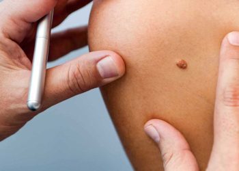 روسيا تستعد لإطلاق أول لقاح لعلاج السرطان خلال خريف 2025