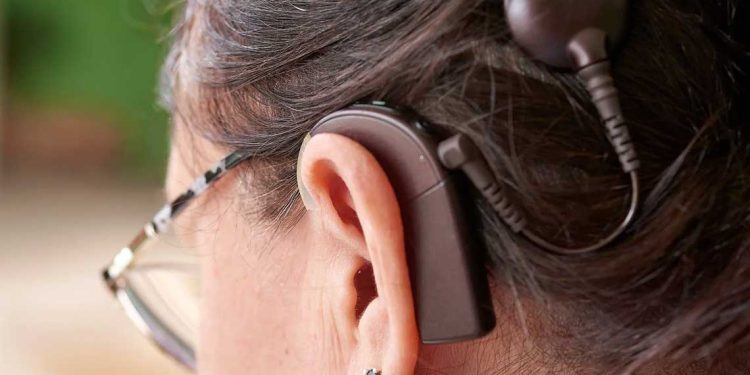 استئناف عمليات زراعة القوقعة السمعية بتلمسان