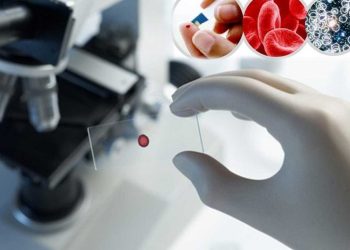 اختراق طبي…تحويل كلية من فصيلة دم A إلى O بنجاح