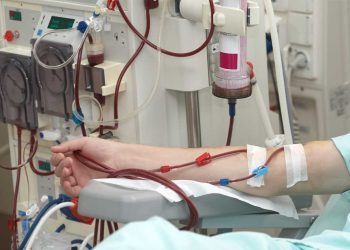 35 ألف مريض يخضعون لتصفية الدم عبر 420 مركزًا